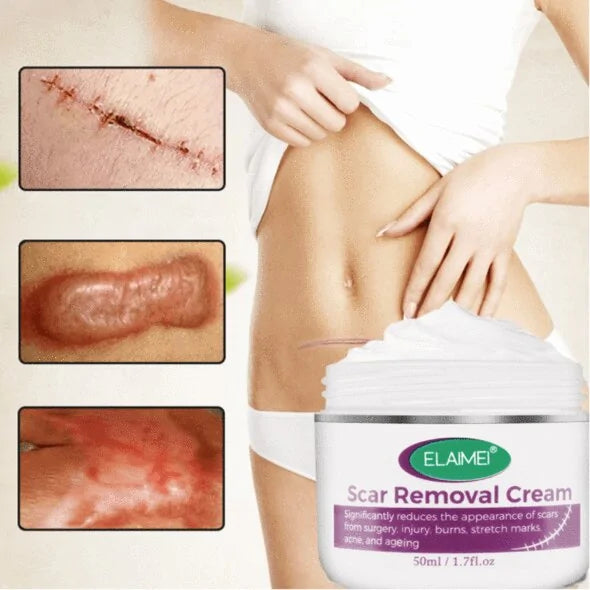 Scar Removal Cream